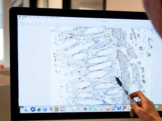 Markers en Panels uitsnede op beeldscherm