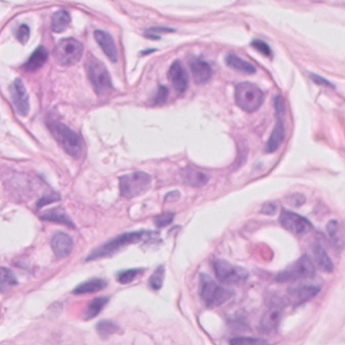 HE hartje