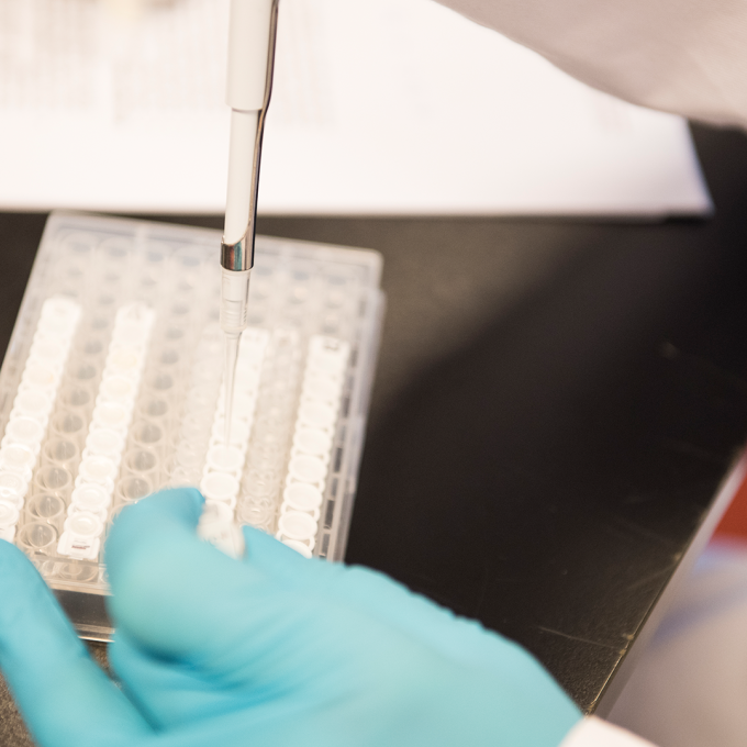 pipetteren